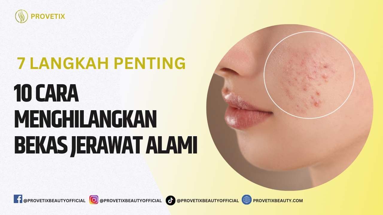 10 Cara Menghilangkan Bekas Jerawat Alami