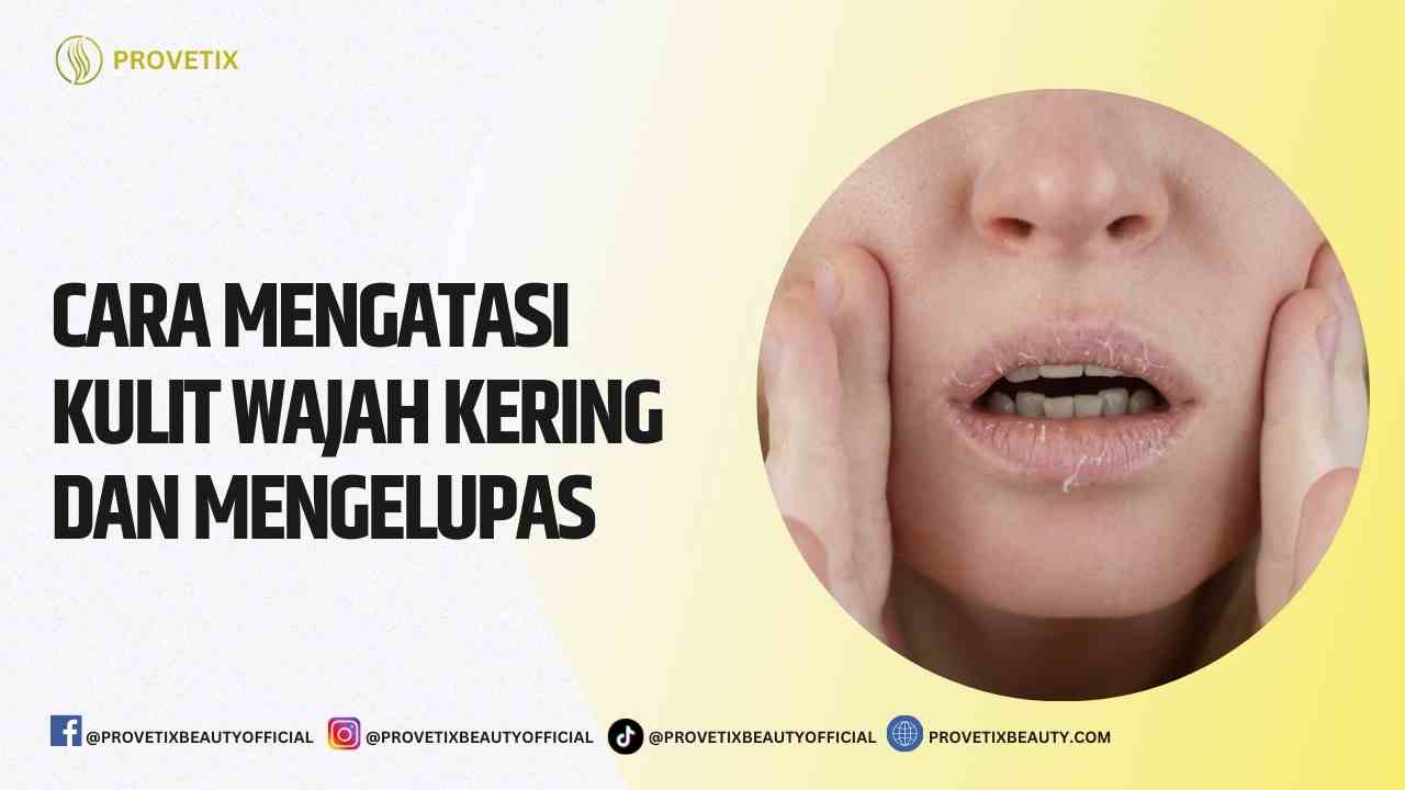 Cara Mengatasi Kulit Wajah Kering dan Mengelupas